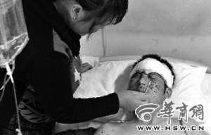 兒子放禮花彈炸斷手掌 父親目睹慘狀腦溢血身亡