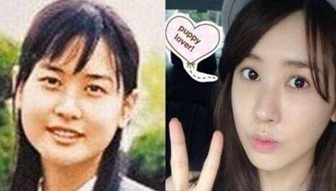 韓國女星疑似整容規模第一名竟是她 變化之大令人驚嘆：像換了一個人？