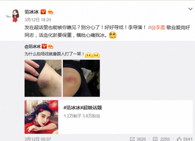 范冰冰受傷 網友好奇-冰冰最近在拍什么戲？