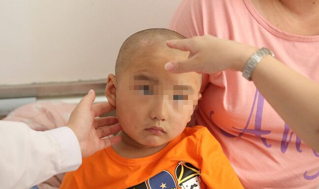 柞水4歲男童患癌 需6個治療周期治療費愁壞父母