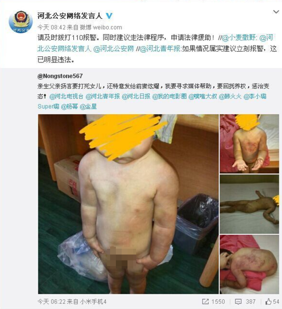 河北男子虐待女兒發圖給前妻炫耀(圖)