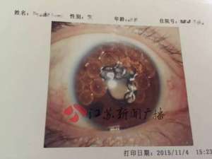 國家衛(wèi)計委回應(yīng)氣體致盲：正在開會研究中