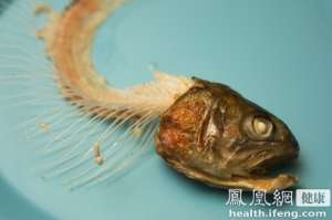 農(nóng)婦頻繁咳嗽呼吸不暢 一根魚骨卡在氣管10年不知
