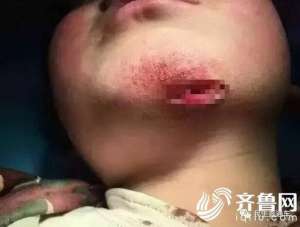 女子虐打男童被拘 網友憤怒：對一個孩子如此殘忍要嚴懲這種行為