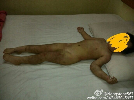 河北男子虐待女兒發圖給前妻炫耀(圖)