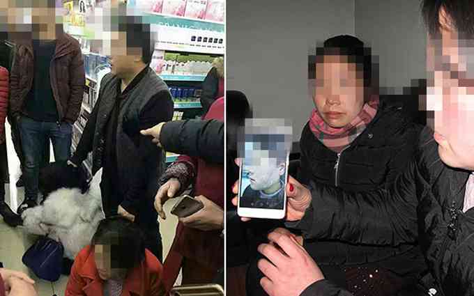 幫女童找家長被毆：女子臉頰被打的通紅深受委屈，但她表示不后悔