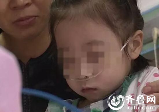 山東一6歲女孩肺功能衰竭如八旬老人
