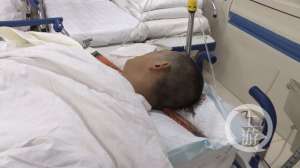 男子被1.5米鋼釬刺穿頸部 能活下來直呼太幸運