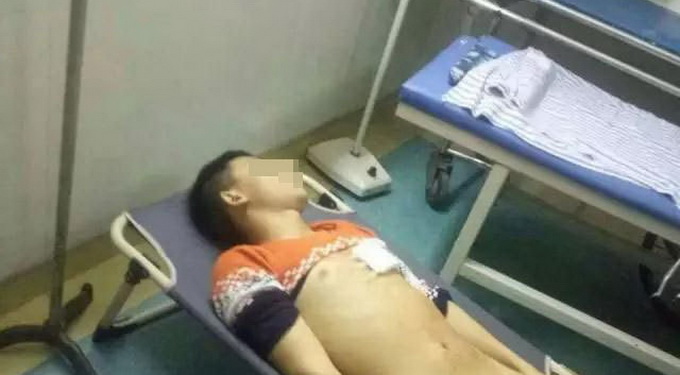 17歲高中生刀砍老師后被老師群毆 學生經搶救無效死亡