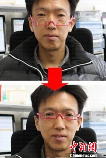 “雙眼皮眼鏡”受熱捧醫生稱配戴不慎損傷眼皮（圖）