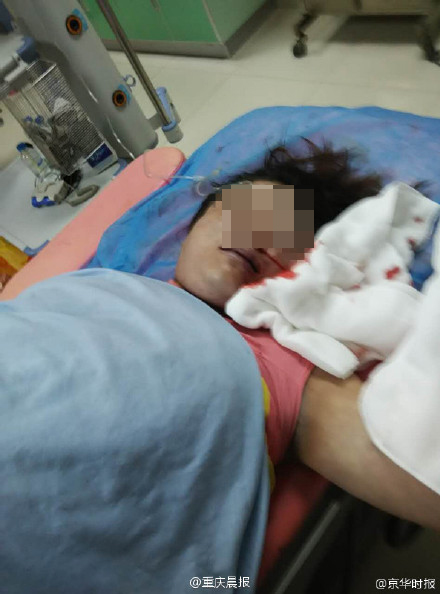 孕婦打無痛分娩針后口吐白沫死亡