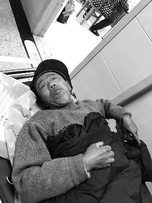 老人腹中現22根繡花針或已存幾十年 家人報警