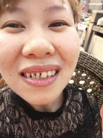 女子被磨掉好牙醫生稱沒責任 私下賠2000被拒