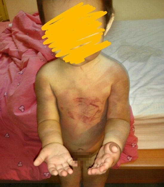 河北男子虐待女兒發圖給前妻炫耀(圖)
